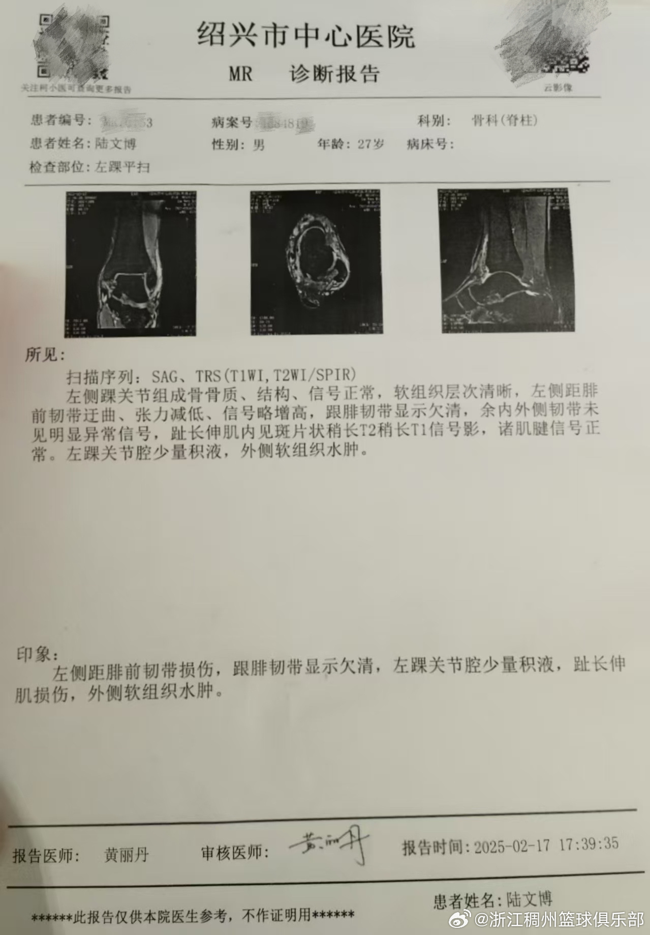 不仅仅是赛